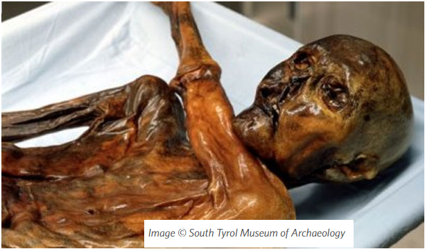 The Iceman's Health Issues